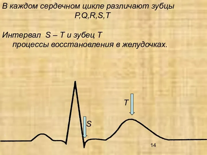 В каждом сердечном цикле различают зубцы P,Q,R,S,T Интервал S – T и