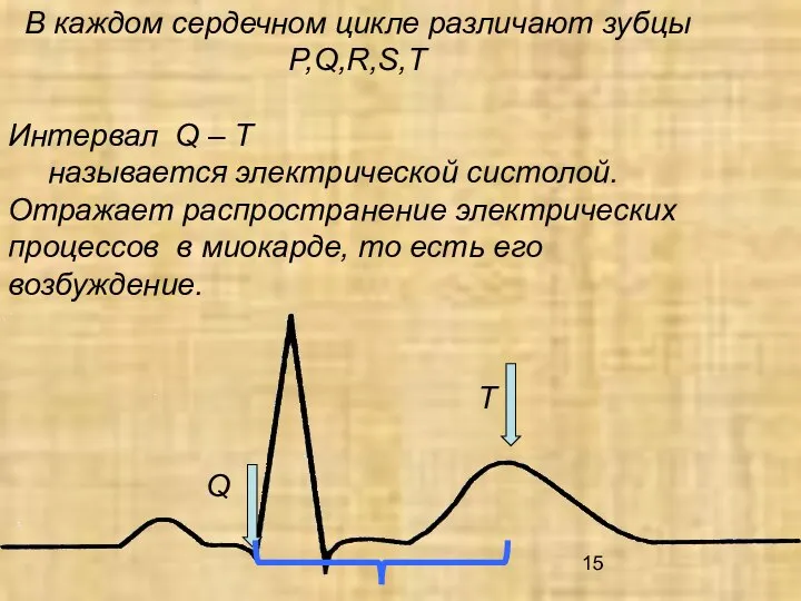 В каждом сердечном цикле различают зубцы P,Q,R,S,T Интервал Q – T называется