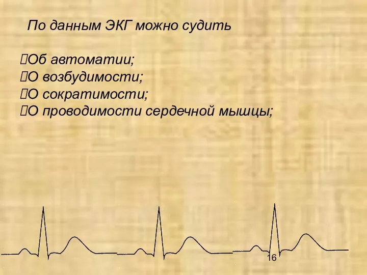 По данным ЭКГ можно судить Об автоматии; О возбудимости; О сократимости; О проводимости сердечной мышцы;