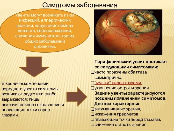 Симптомы заболевания Увеиты могут возникать из-за инфекций, аллергических реакций, нарушения обмена веществ,