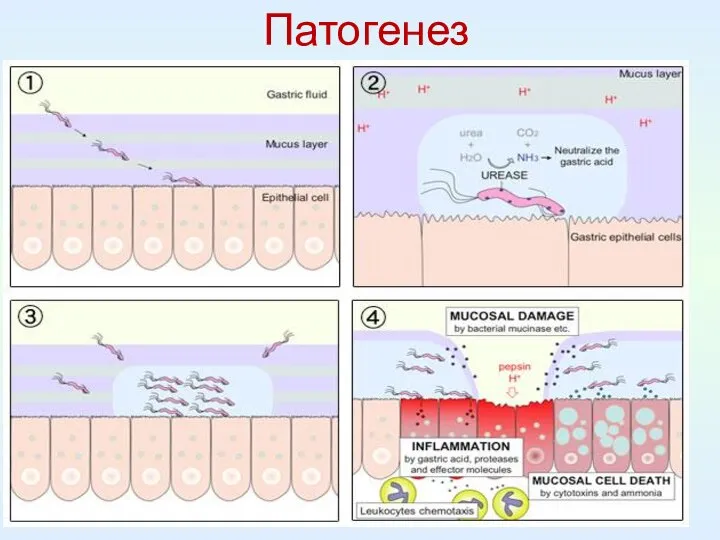 Патогенез