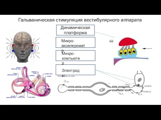 Гальваническая стимуляция вестибулярного аппарата Микро- акселерометр Микро- компьютер Электроды Динамическая платформа