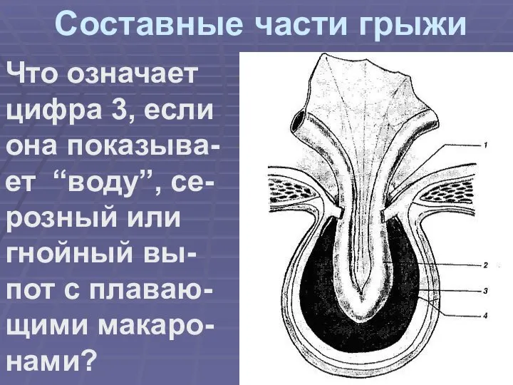 Составные части грыжи Что означает цифра 3, если она показыва-ет “воду”, се-розный