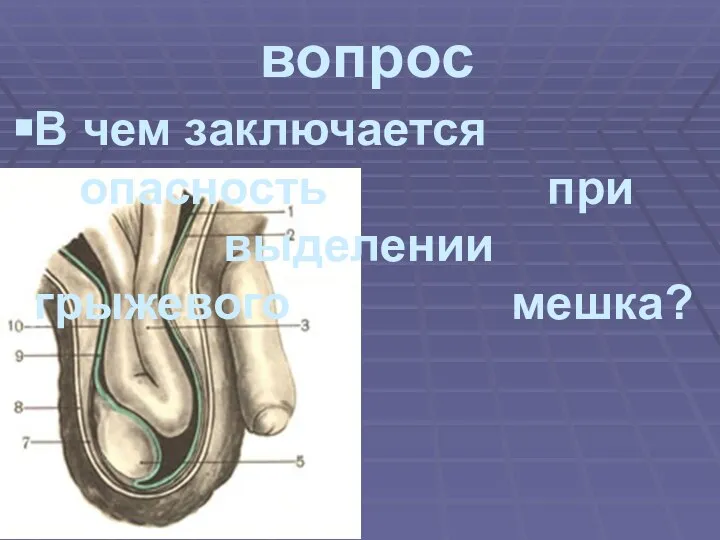 вопрос В чем заключается опасность при выделении грыжевого мешка?