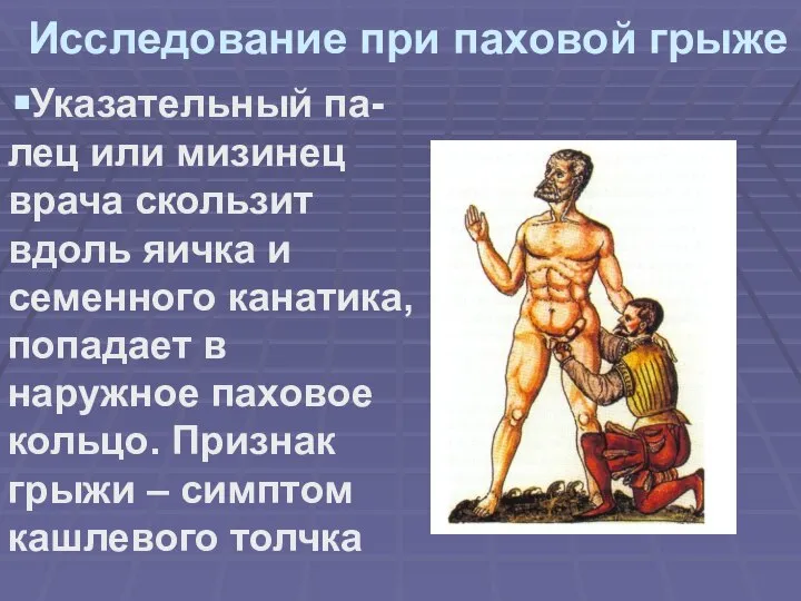 Исследование при паховой грыже Указательный па-лец или мизинец врача скользит вдоль яичка