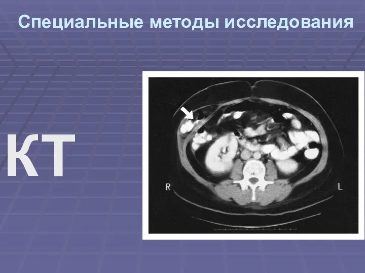 Специальные методы исследования КТ