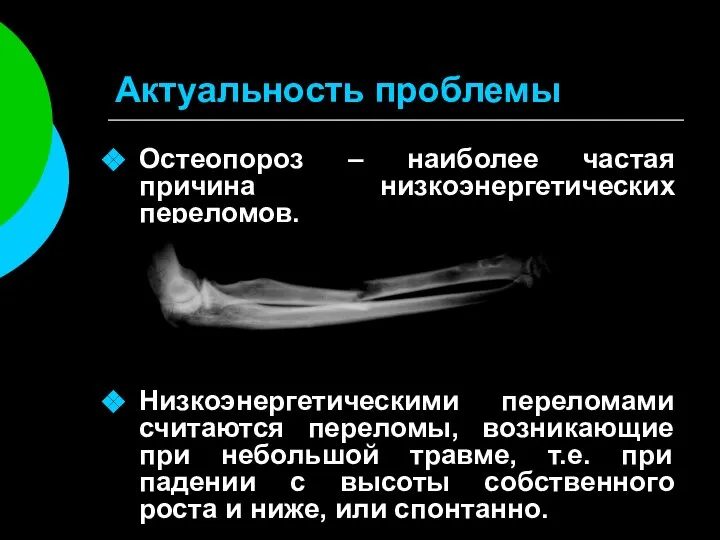 Актуальность проблемы Остеопороз – наиболее частая причина низкоэнергетических переломов. Низкоэнергетическими переломами считаются