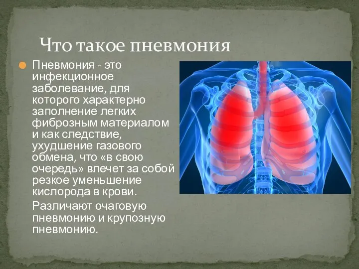 Пневмония - это инфекционное заболевание, для которого характерно заполнение легких фиброзным материалом