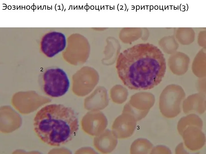Эозинофилы (1), лимфоциты (2), эритроциты(3)