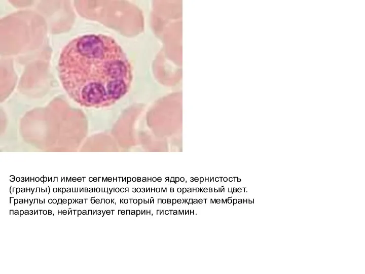 Эозинофил имеет сегментированое ядро, зернистость(гранулы) окрашивающуюся эозином в оранжевый цвет. Гранулы содержат