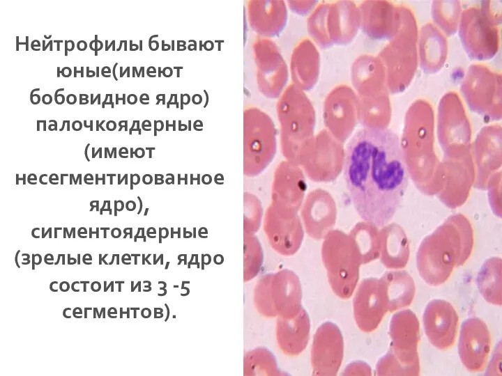 Нейтрофилы бывают юные(имеют бобовидное ядро) палочкоядерные (имеют несегментированное ядро), сигментоядерные(зрелые клетки, ядро