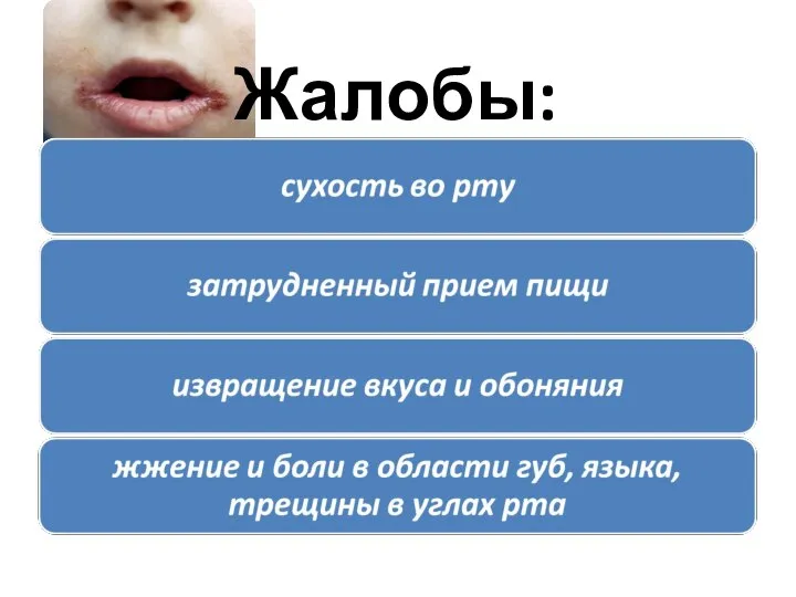 Жалобы: