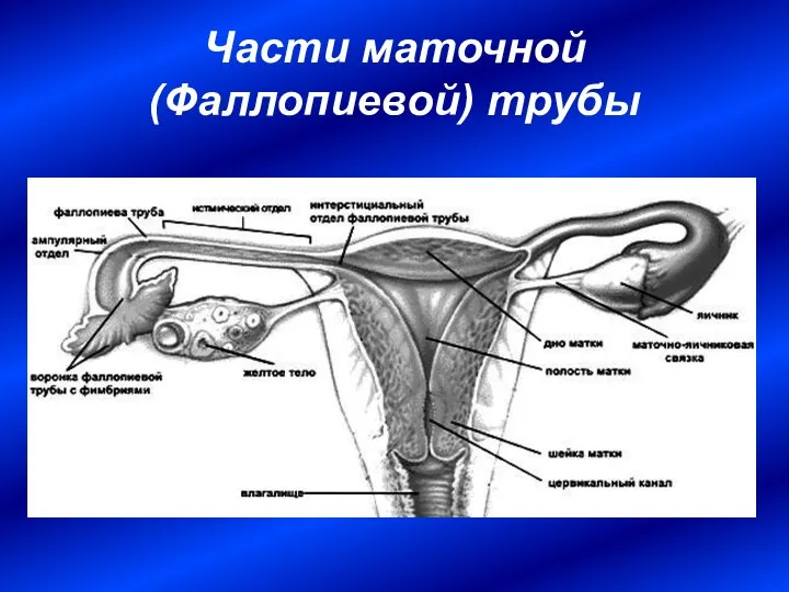 Части маточной (Фаллопиевой) трубы