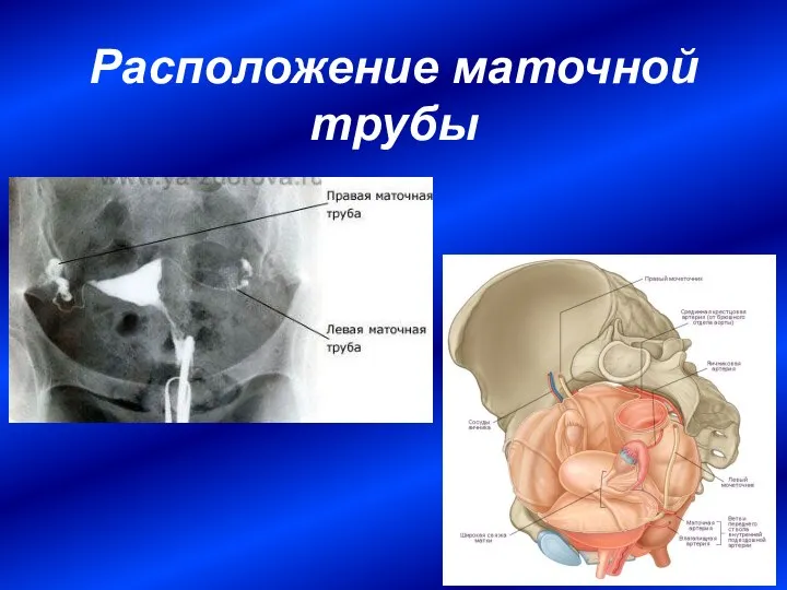 Расположение маточной трубы