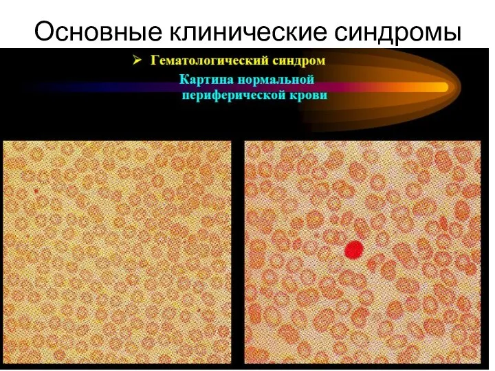 Основные клинические синдромы