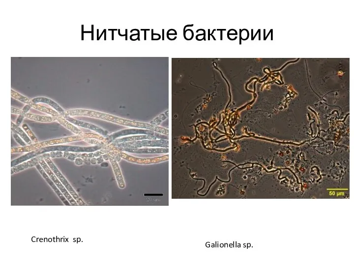 Нитчатые бактерии Crenothrix sp. Galionella sp.