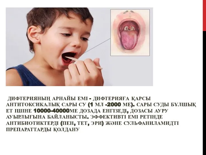 ДИФТЕРИЯНЫҢ АРНАЙЫ ЕМІ - ДИФТЕРИЯҒА ҚАРСЫ АНТИТОКСИКАЛЫҚ САРЫ СУ (1 МЛ -2000