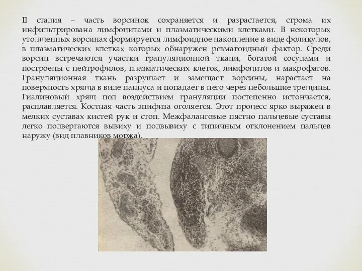 II стадия – часть ворсинок сохраняется и разрастается, строма их инфильтрирована лимфоцитами