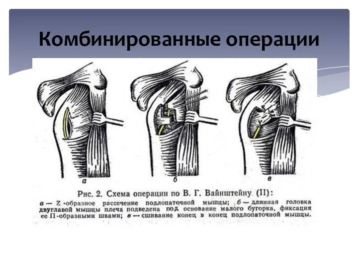 Комбинированные операции