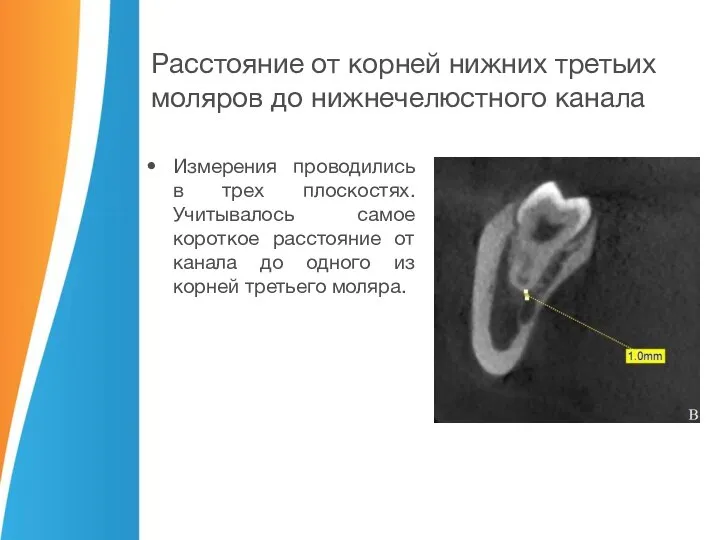 Измерения проводились в трех плоскостях. Учитывалось самое короткое расстояние от канала до