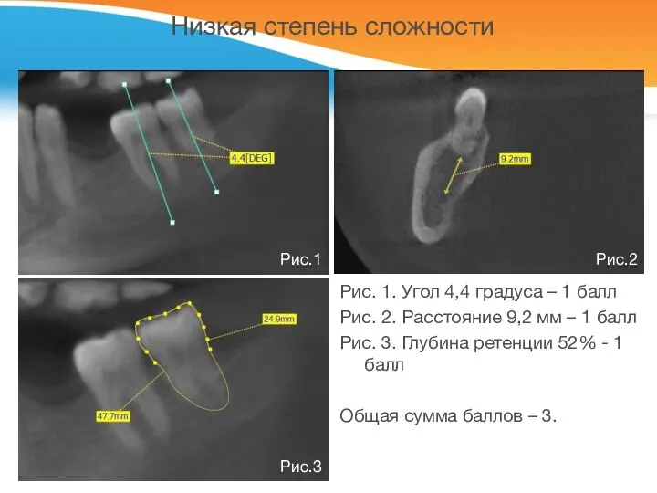 Низкая степень сложности Рис. 1. Угол 4,4 градуса – 1 балл Рис.