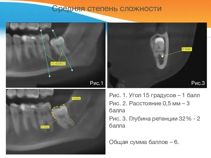 Средняя степень сложности Рис. 1. Угол 15 градусов – 1 балл Рис.