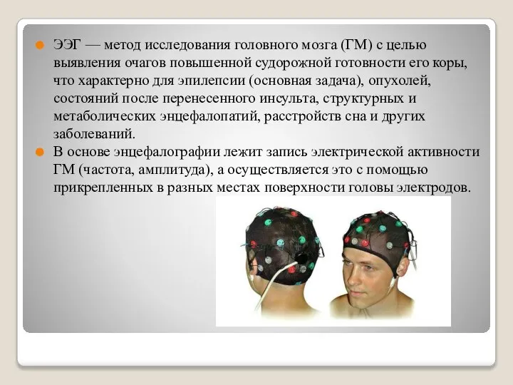 ЭЭГ — метод исследования головного мозга (ГМ) с целью выявления очагов повышенной