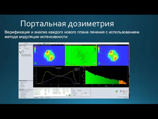 Портальная дозиметрия Верификация и анализ каждого нового плана лечения с использованием метода модуляции интенсивности