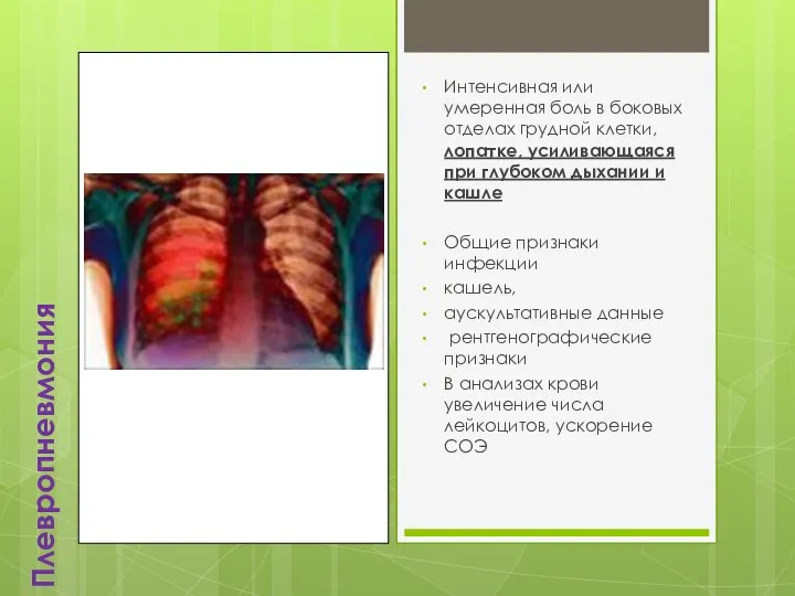 Плевропневмония Интенсивная или умеренная боль в боковых отделах грудной клетки, лопатке, усиливающаяся