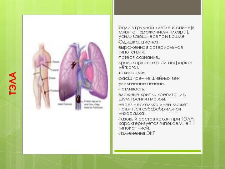 ТЭЛА боли в грудной клетке и спине(в связи с поражением плевры), усиливающиеся