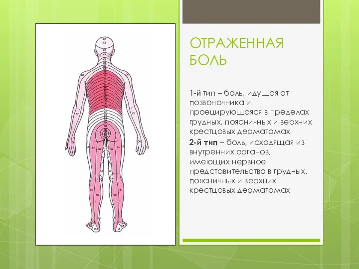 ОТРАЖЕННАЯ БОЛЬ 1-й тип – боль, идущая от позвоночника и проецирующаяся в