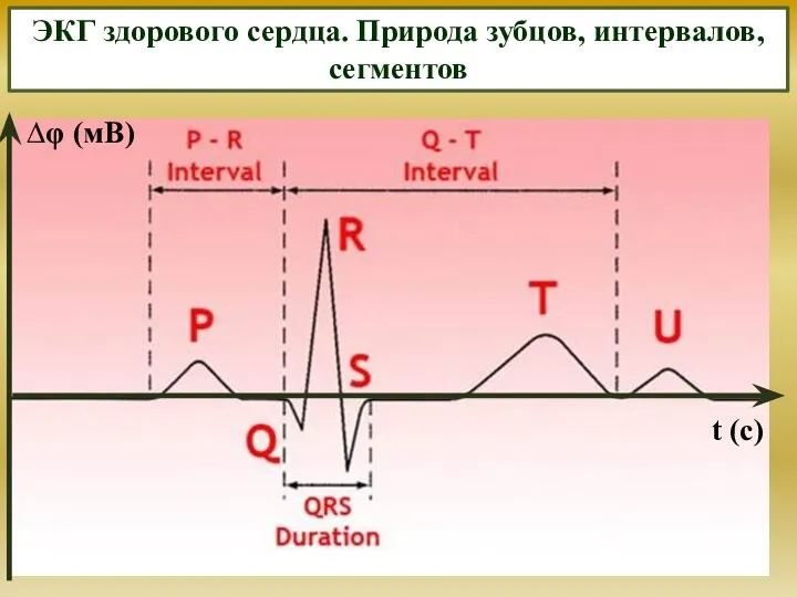 ЭКГ здорового сердца. Природа зубцов, интервалов, сегментов t (с)