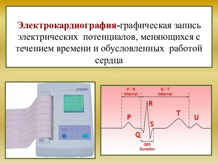 Электрокардиография-графическая запись электрических потенциалов, меняющихся с течением времени и обусловленных работой сердца