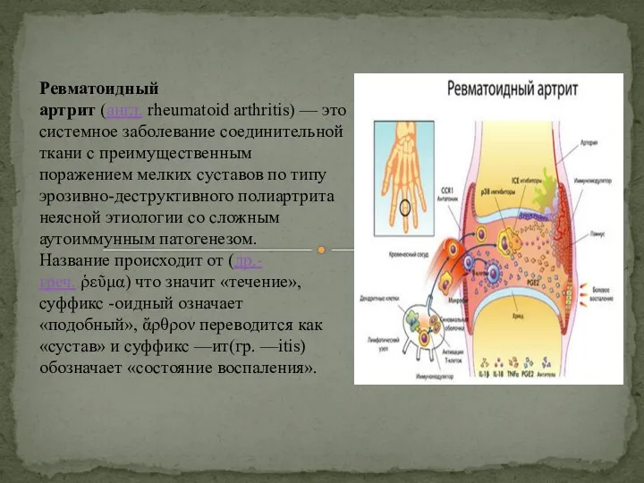 Ревматоидный артрит (англ. rheumatoid arthritis) — это системное заболевание соединительной ткани с