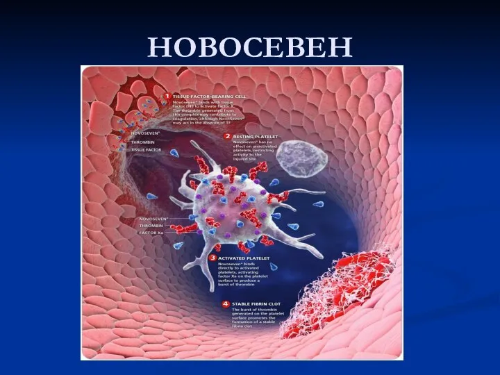 НОВОСЕВЕН