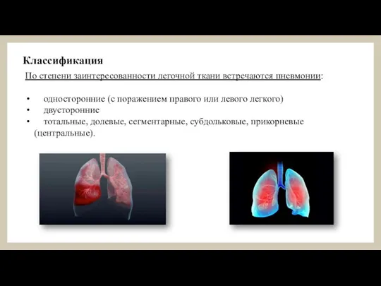 По степени заинтересованности легочной ткани встречаются пневмонии: односторонние (с поражением правого или