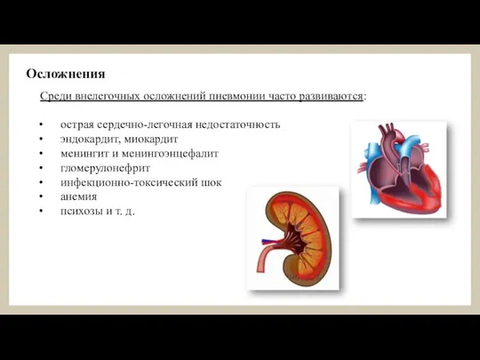 Осложнения Среди внелегочных осложнений пневмонии часто развиваются: острая сердечно-легочная недостаточность эндокардит, миокардит