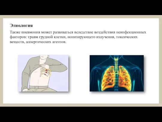 Также пневмония может развиваться вследствие воздействия неинфекционных факторов: травм грудной клетки, ионизирующего