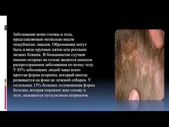 Заболевание кожи головы и тела, представляющее несколько видов чешуйчатых лишаев. Образования могут
