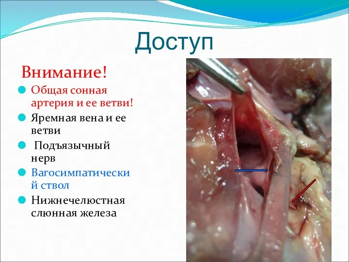 Доступ Внимание! Общая сонная артерия и ее ветви! Яремная вена и ее