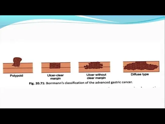 MORPHOLOGY OF FUNGI (a) General. Fungi vary widely in size and shape,