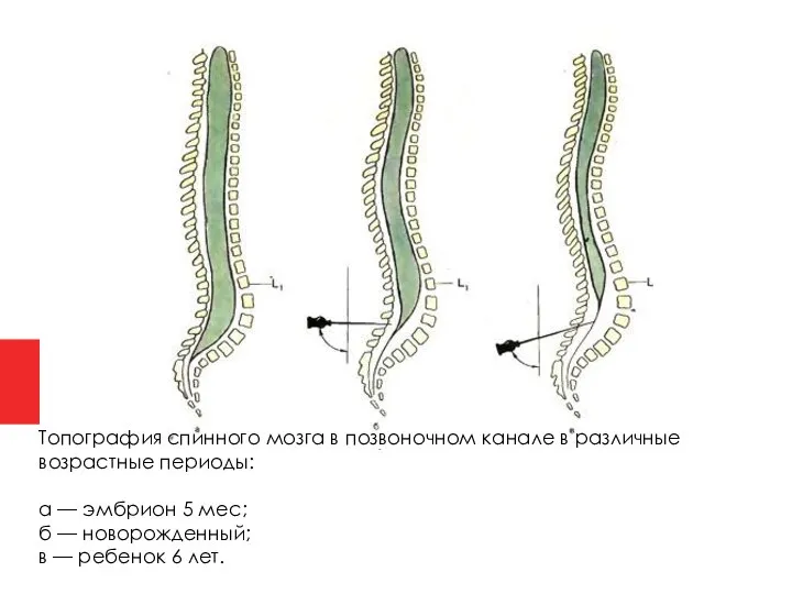 Топография спинного мозга в позвоночном канале в различные возрастные периоды: а —