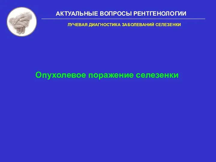 АКТУАЛЬНЫЕ ВОПРОСЫ РЕНТГЕНОЛОГИИ Опухолевое поражение селезенки ЛУЧЕВАЯ ДИАГНОСТИКА ЗАБОЛЕВАНИЙ СЕЛЕЗЕНКИ