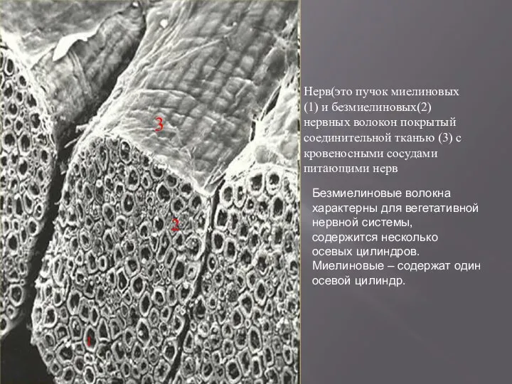 прозрачного perineurium. Нерв(это пучок миелиновых (1) и безмиелиновых(2) нервных волокон покрытый соединительной