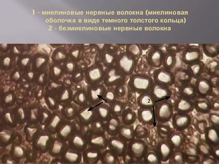 1 - миелиновые нервные волокна (миелиновая оболочка в виде темного толстого кольца)