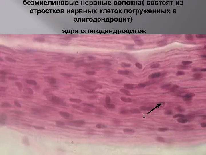 безмиелиновые нервные волокна( состоят из отростков нервных клеток погруженных в олигодендроцит) ядра олигодендроцитов 1