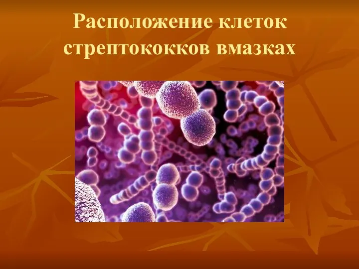 Расположение клеток стрептококков вмазках