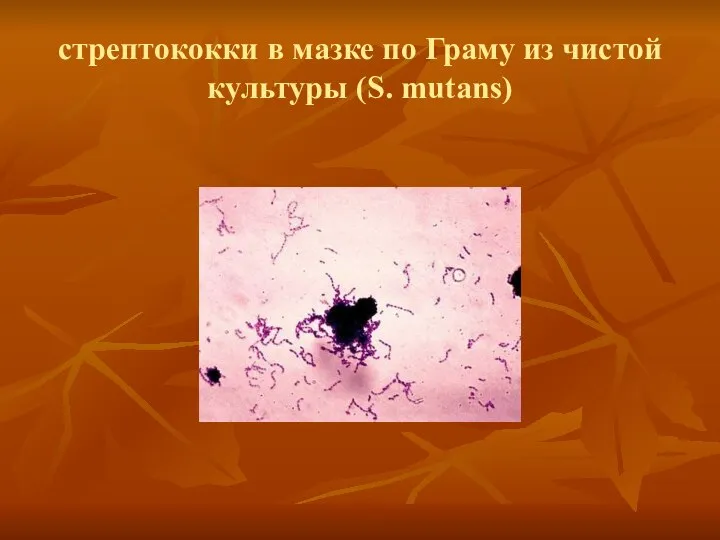 стрептококки в мазке по Граму из чистой культуры (S. mutans)