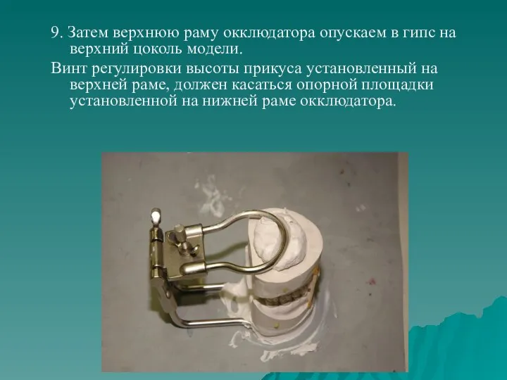 9. Затем верхнюю раму окклюдатора опускаем в гипс на верхний цоколь модели.