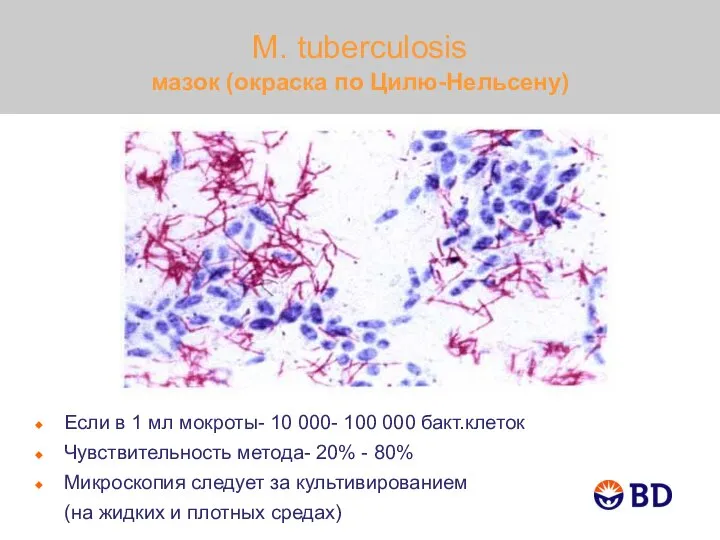 M. tuberculosis мазок (окраска по Цилю-Нельсену) Если в 1 мл мокроты- 10